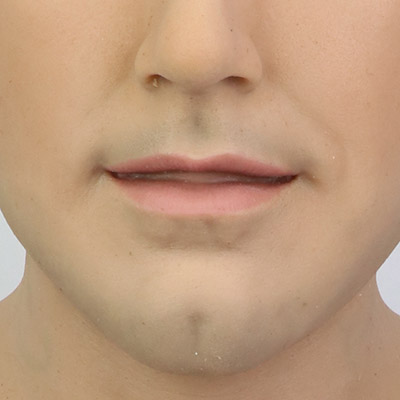 No Beard