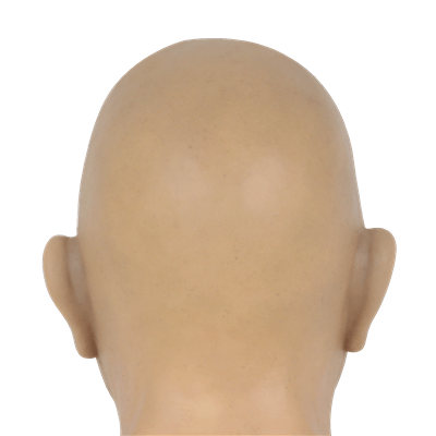 No Hair