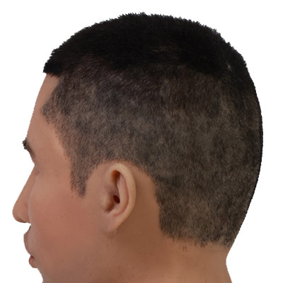 Hair