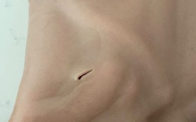 Five steps to repair the damaged silicone products