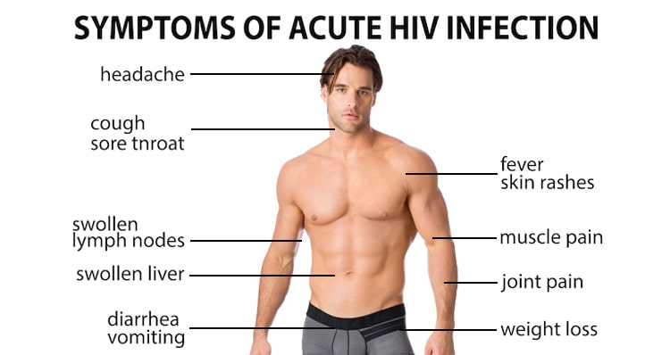 hiv