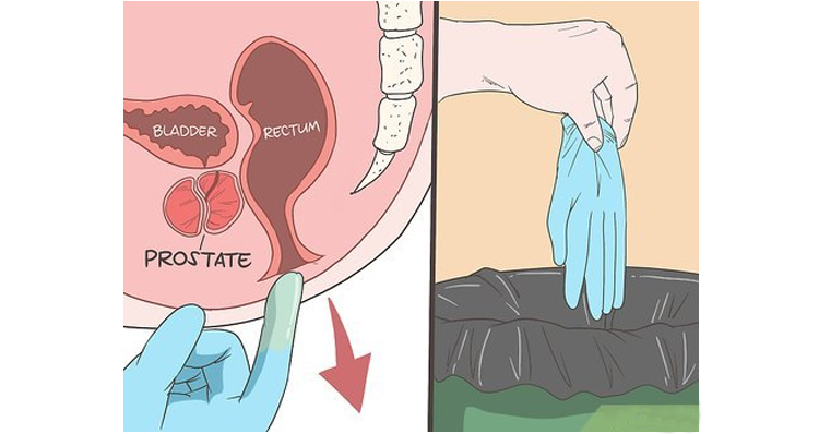 Prostate Play