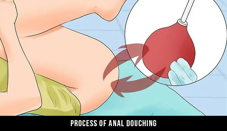 Process of anal douching