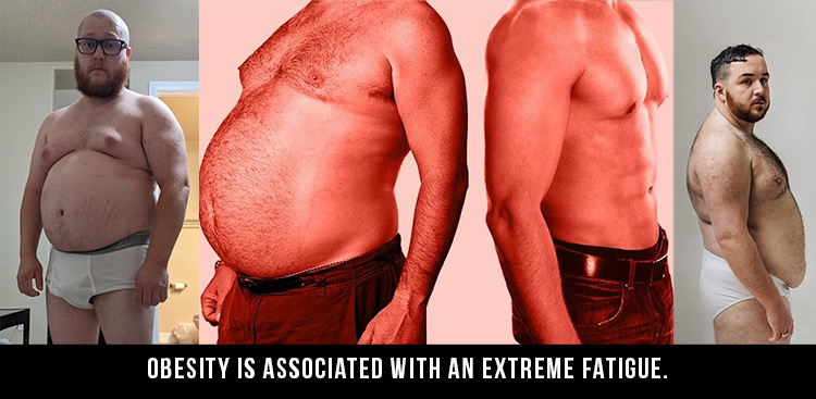 You Are Overweight