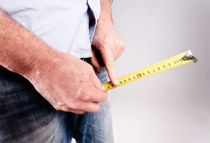 Measuring the Length of the Penis for Cage Selection